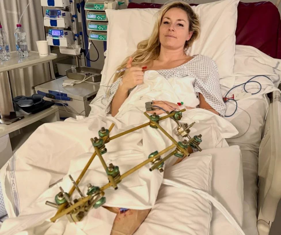 Vonn ‘making progress’ after third leg operation