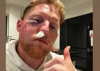 Stokes injured after being hit in face by ball